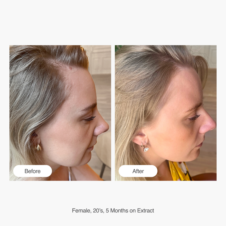 Hair Gain Extract